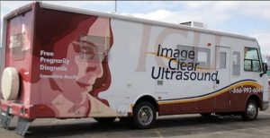 Mobile Ultrasound Unit of TLC Pregnancy Services, Elgin, IL
